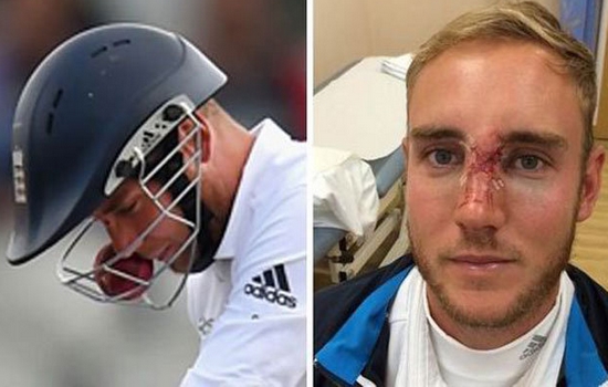 Stuart Broad Critical Injury in Cricket 